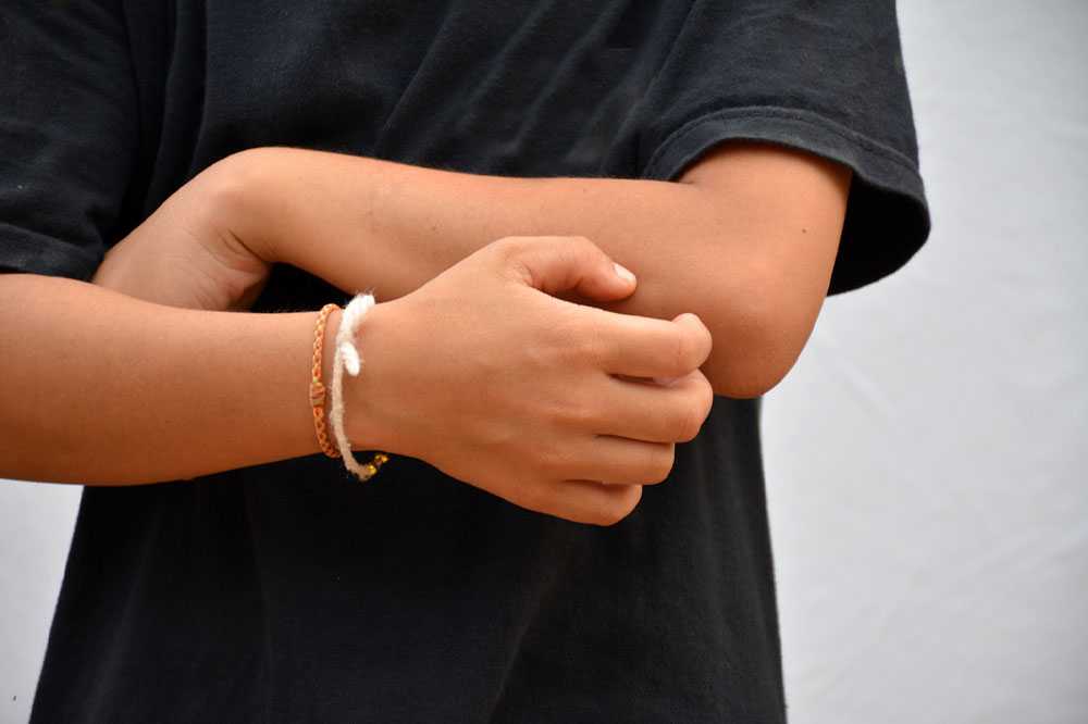 Prurigo nodularis – Causes, symptoms, and management